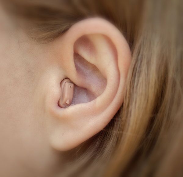 Im-Ohr-Hörgerät Tragebild